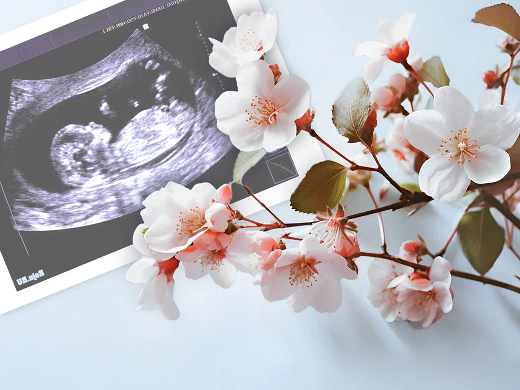 PCOS是一种内分泌失调,会扰乱月经周期并可导致不孕。 因此,这样的诊断可以大大降低成功怀孕的机会。 2.jpg