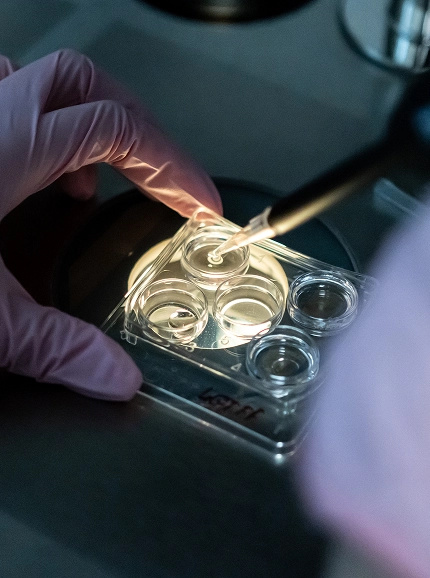 ВМИ (Внутриматочная инсеминация)